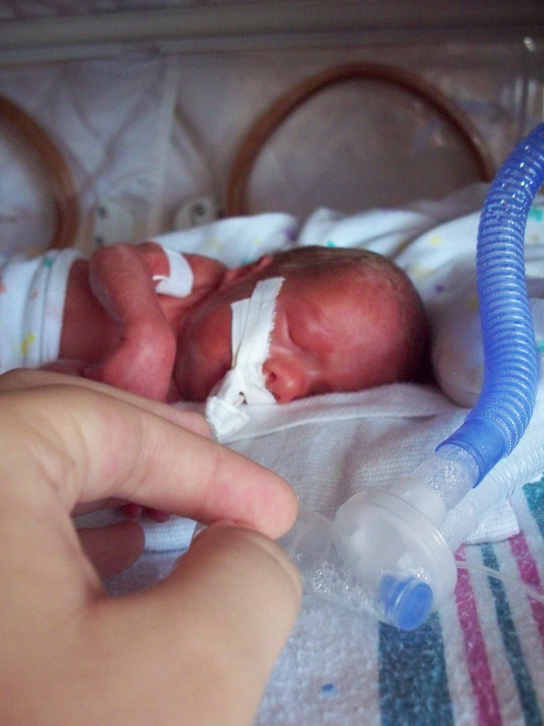 NICU